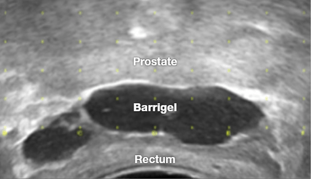 lc-images-trus-3 1 lc-images-trus-3 1